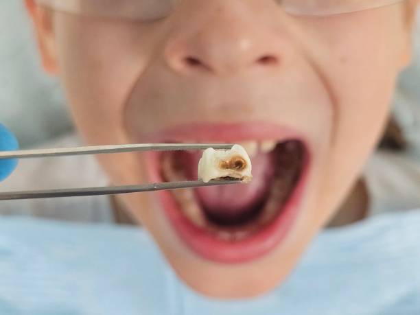 Best Weekend Emergency Dentist in Albers, IL