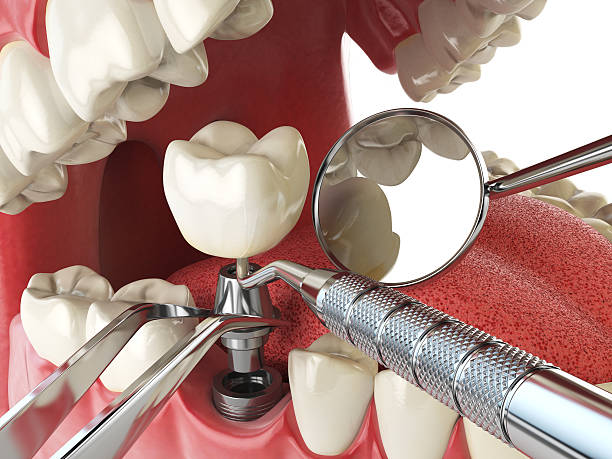 Best Walk-In Emergency Dentist in Albers, IL